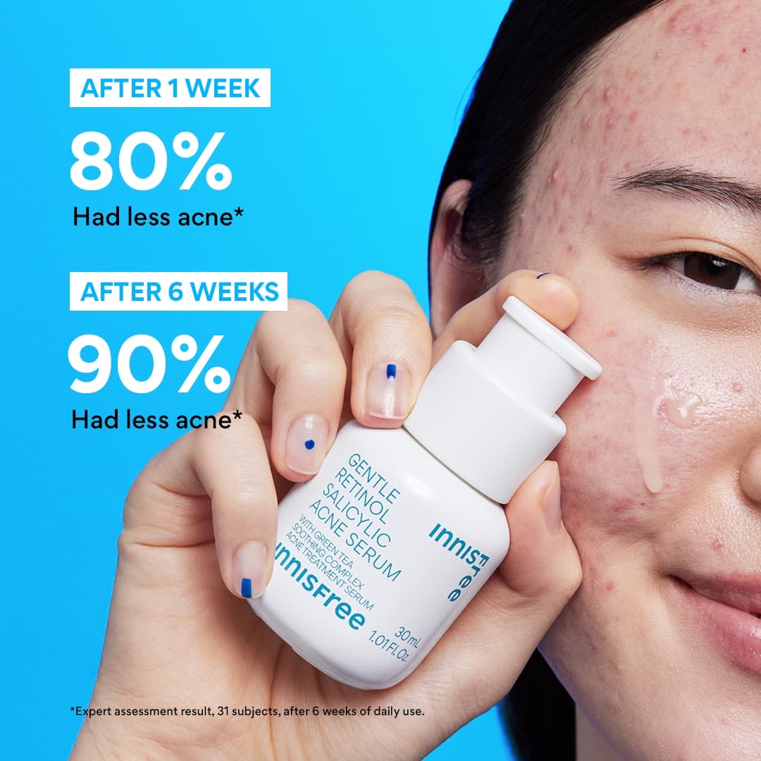 Retinol Acne Treatment for Face | Gentle Retinol Salicylic Acne