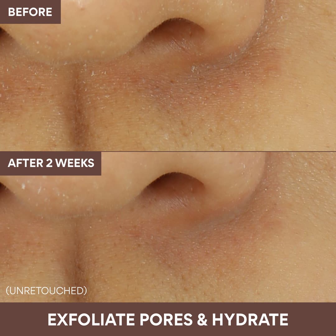 Volcanic Swirl Pore Mask