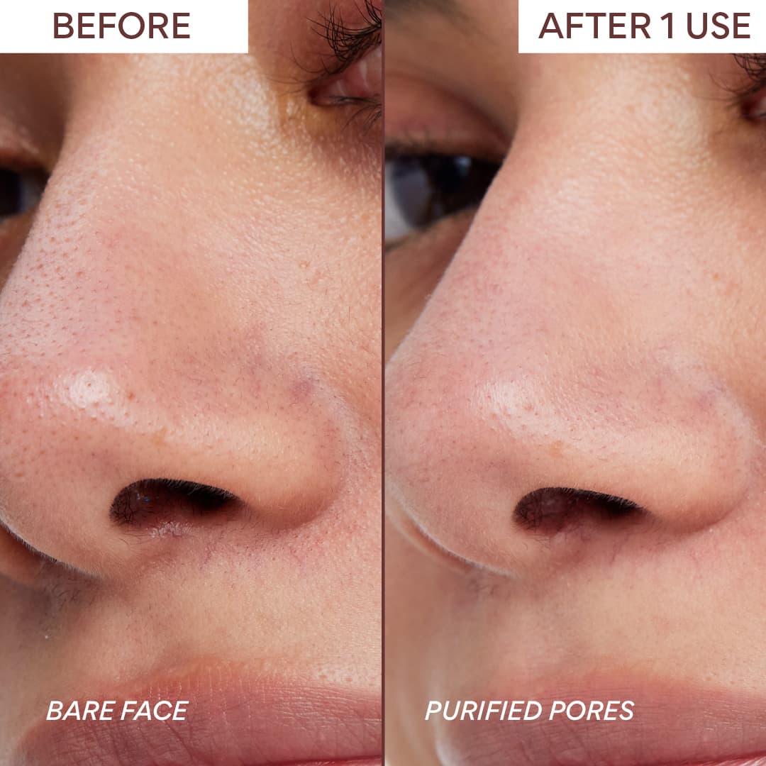 Volcanic Clay Mask, Original- before and after
