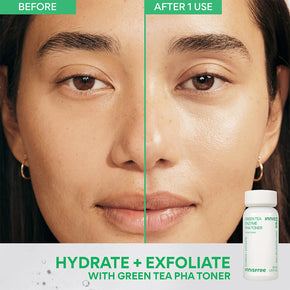 Glow + Brighten - Before & After Green Tea Enzyme PHA Toner