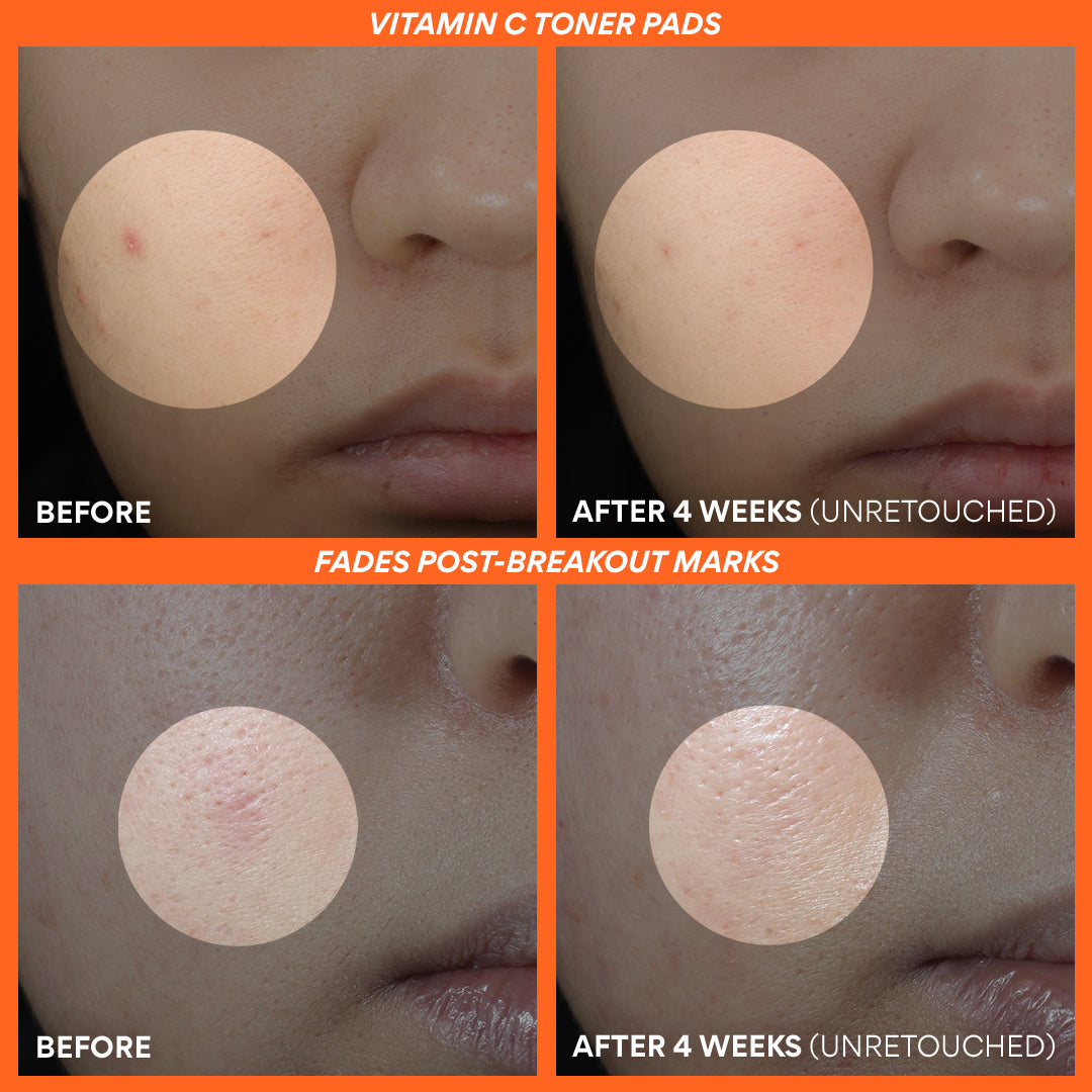 Vitamin C Brightening Power Duo