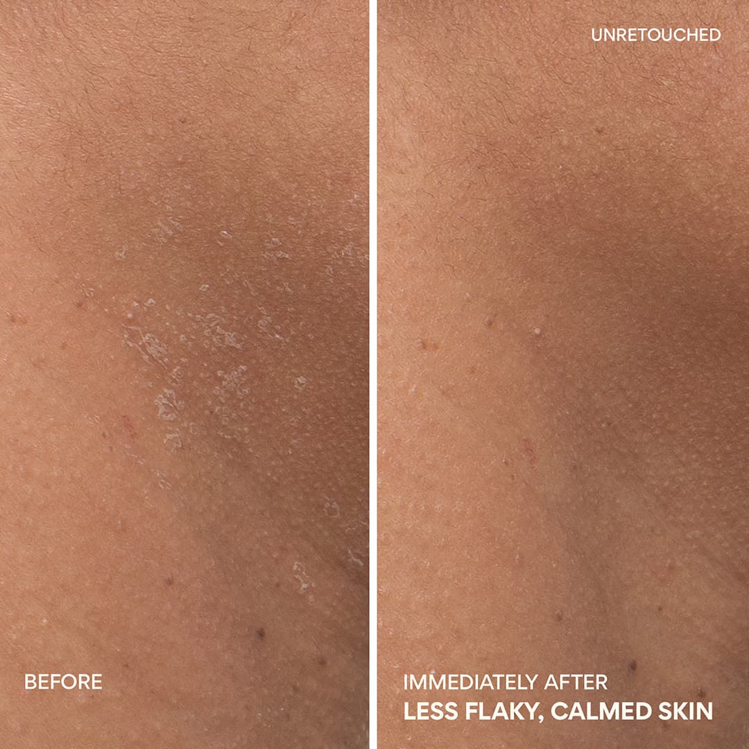 Green Tea Ceramide Cream gives less flaky and calmed skin immediately after using it