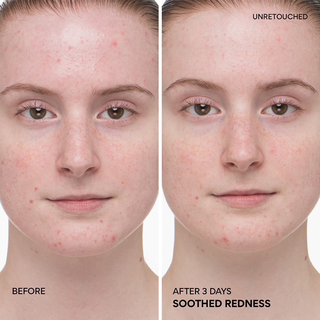 Green Tea Ceramide Milk Barrier Essence soothes redness in 3 days