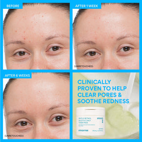 Gentle Retinol Power Duo