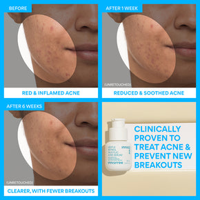 Gentle Retinol Power Duo