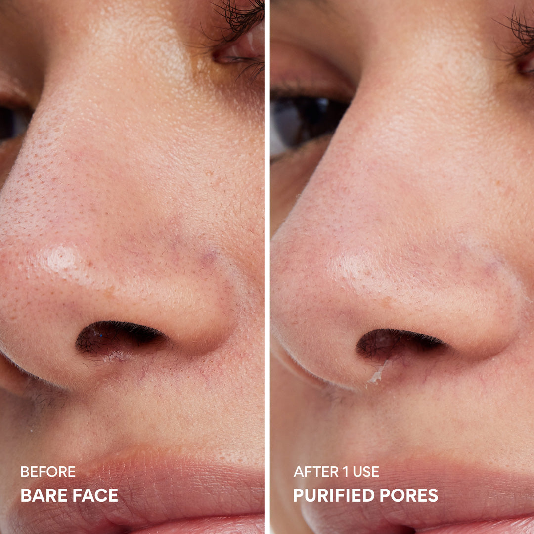 Super Volcanic Clay Mask before and after 1 use, purified pores