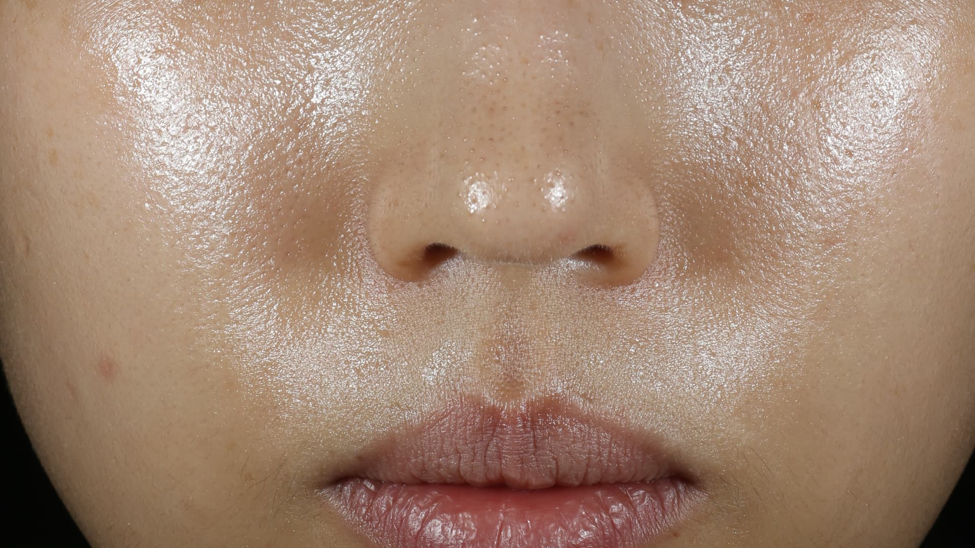 Retinol Green Tea PDRN™ Skinbooster Toner after results