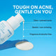 Enlarge image of Gentle Retinol Salicylic Acne Serum