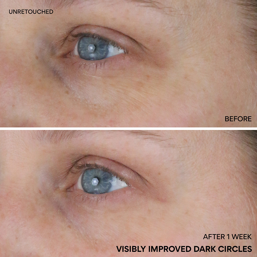 Vitamin C Niacinamide Brightening Eye Serum for Dark Circles