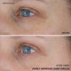 Enlarge image of Vitamin C Niacinamide Brightening Eye Serum before and after one week visibly improved dark circles