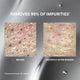 Enlarge image of Before-and-after close-up comparison of skin pores and impurities, with text reading &amp;#39;REMOVES 99% OF IMPURITIES*&amp;#39; and &amp;#39;BEFORE&amp;#39; / &amp;#39;INSTANTLY AFTER RINSING&amp;#39; on a metallic gray background.