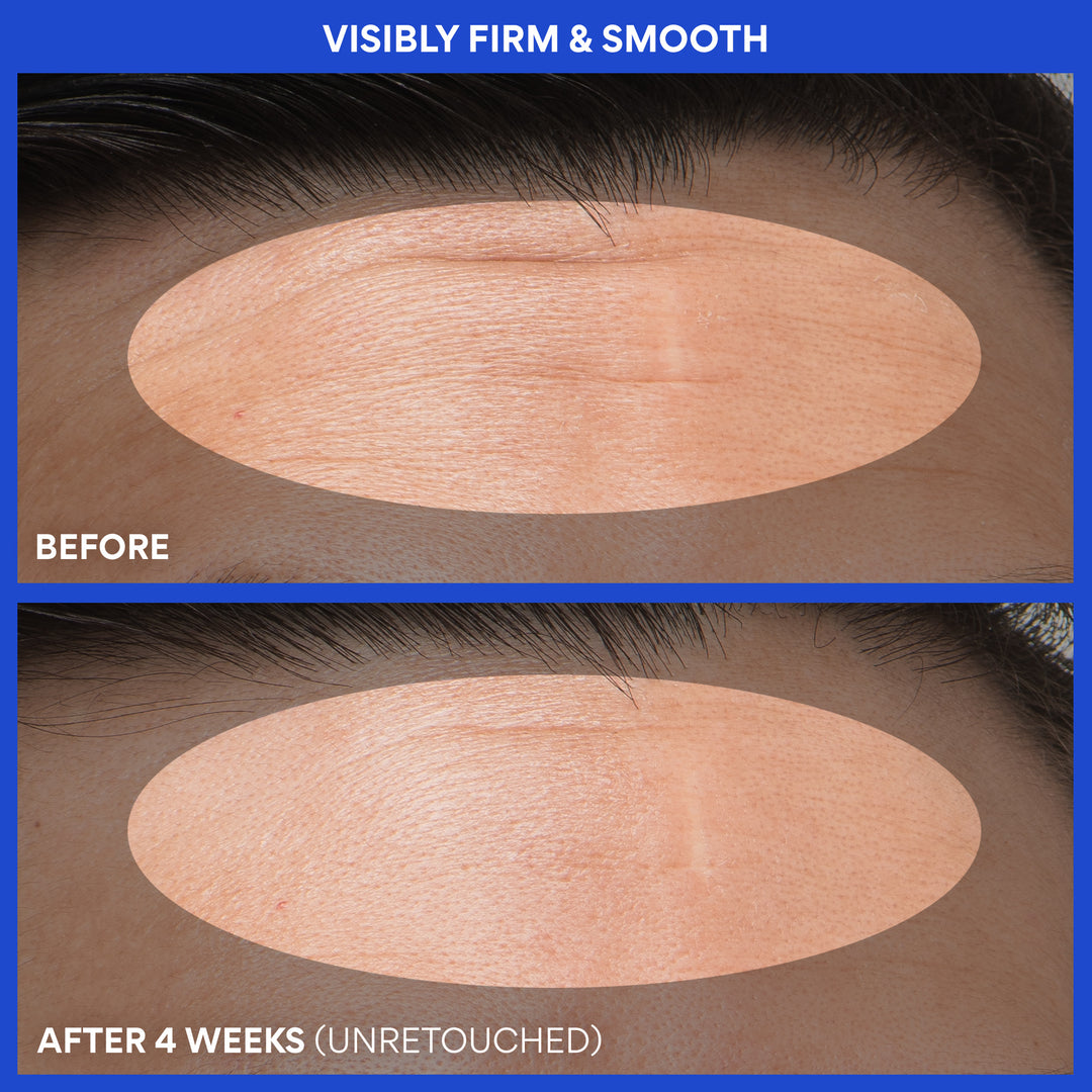 Retinol Green Tea PDRN™ Firming Serum before and after 4 weeks: visibly firm & smooth skin
