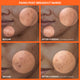 Enlarge image of Before and after comparison of fading post-breakout marks on skin with an orange border