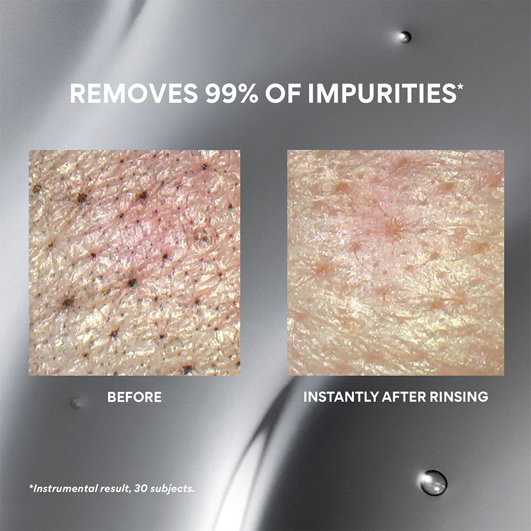Black Volcanic Cleansing Oil before and instantly after rinsing, removes 99% of impurties*