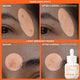 Enlarge image of Before and after comparison of fading dark spots and post-breakout marks on skin with Vitamin C Brightening Serum