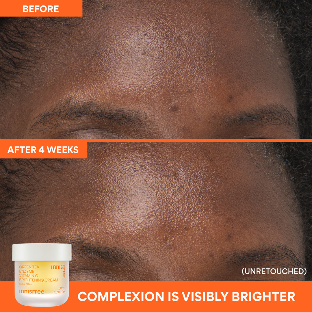 Before and after comparison of a person's forehead where complexion is visibly brighter with Vitamin C Brightening Cream