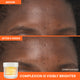 Enlarge image of Before and after comparison of a person&amp;#39;s forehead where complexion is visibly brighter with Vitamin C Brightening Cream