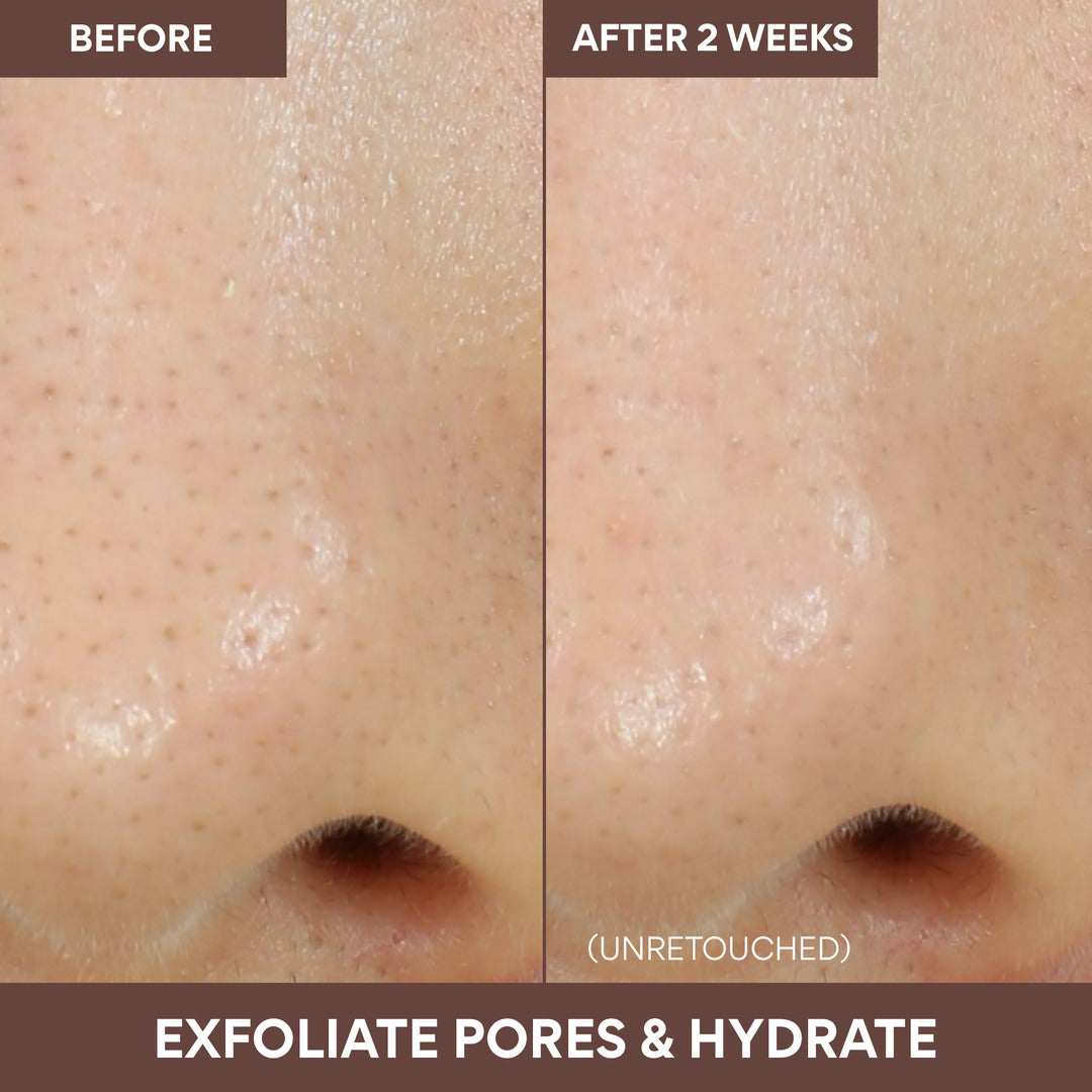 Volcanic Swirl Mask before and after 2 weeks