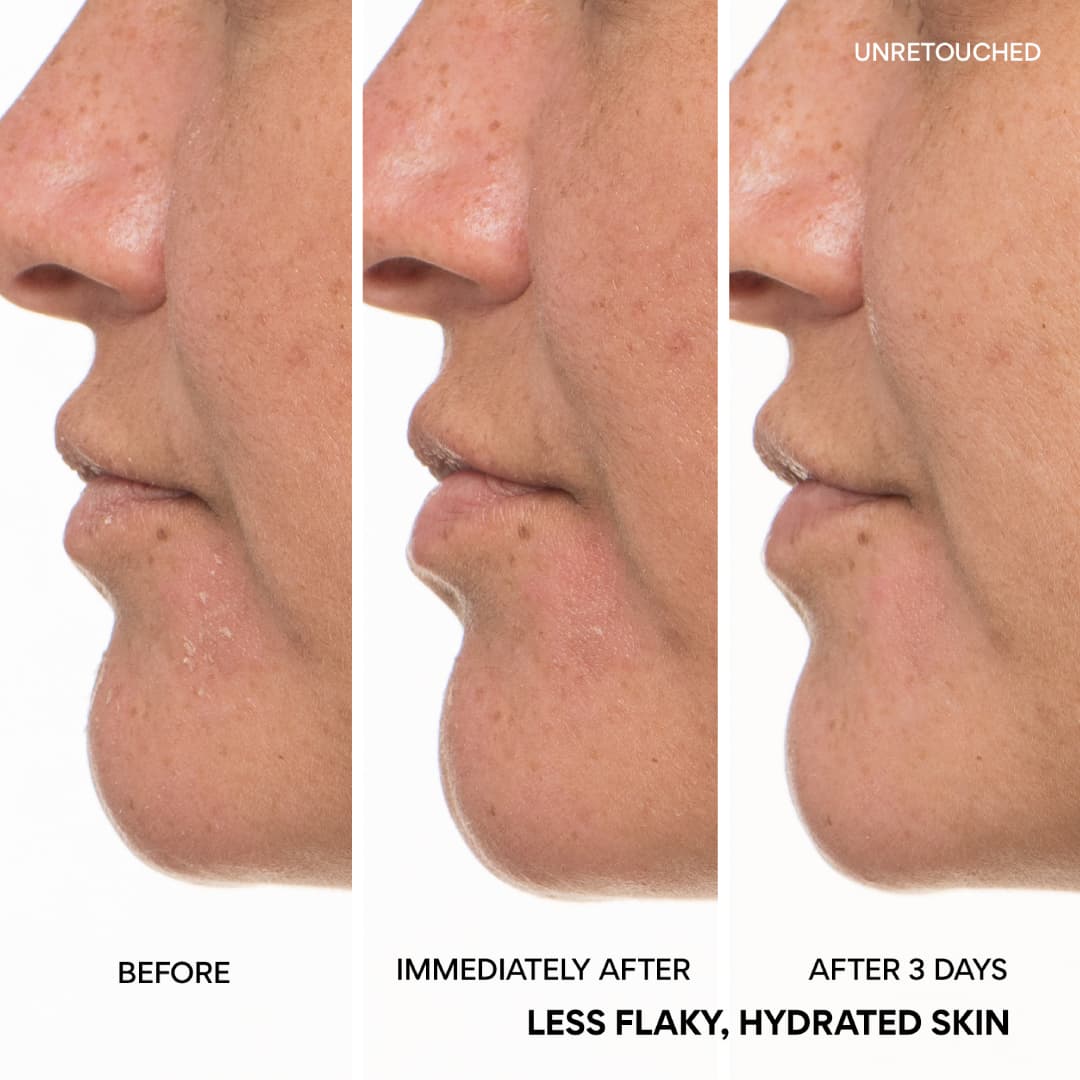 Green Tea Ceramide Milk before and after, less flaky, hydrated skin