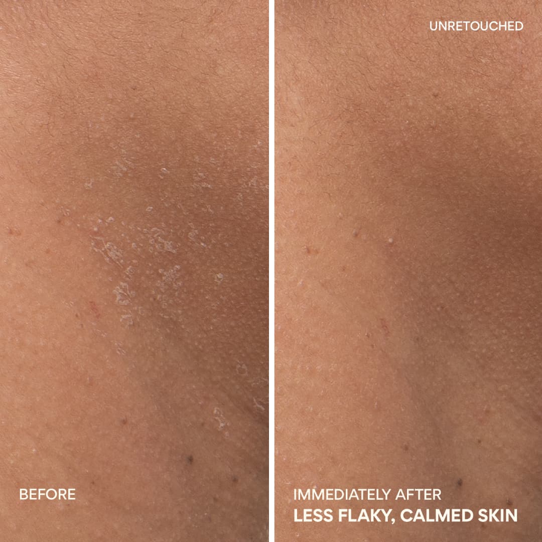 Green Tea Ceramide Cream before and after immediately after, less flaky, calmed skin