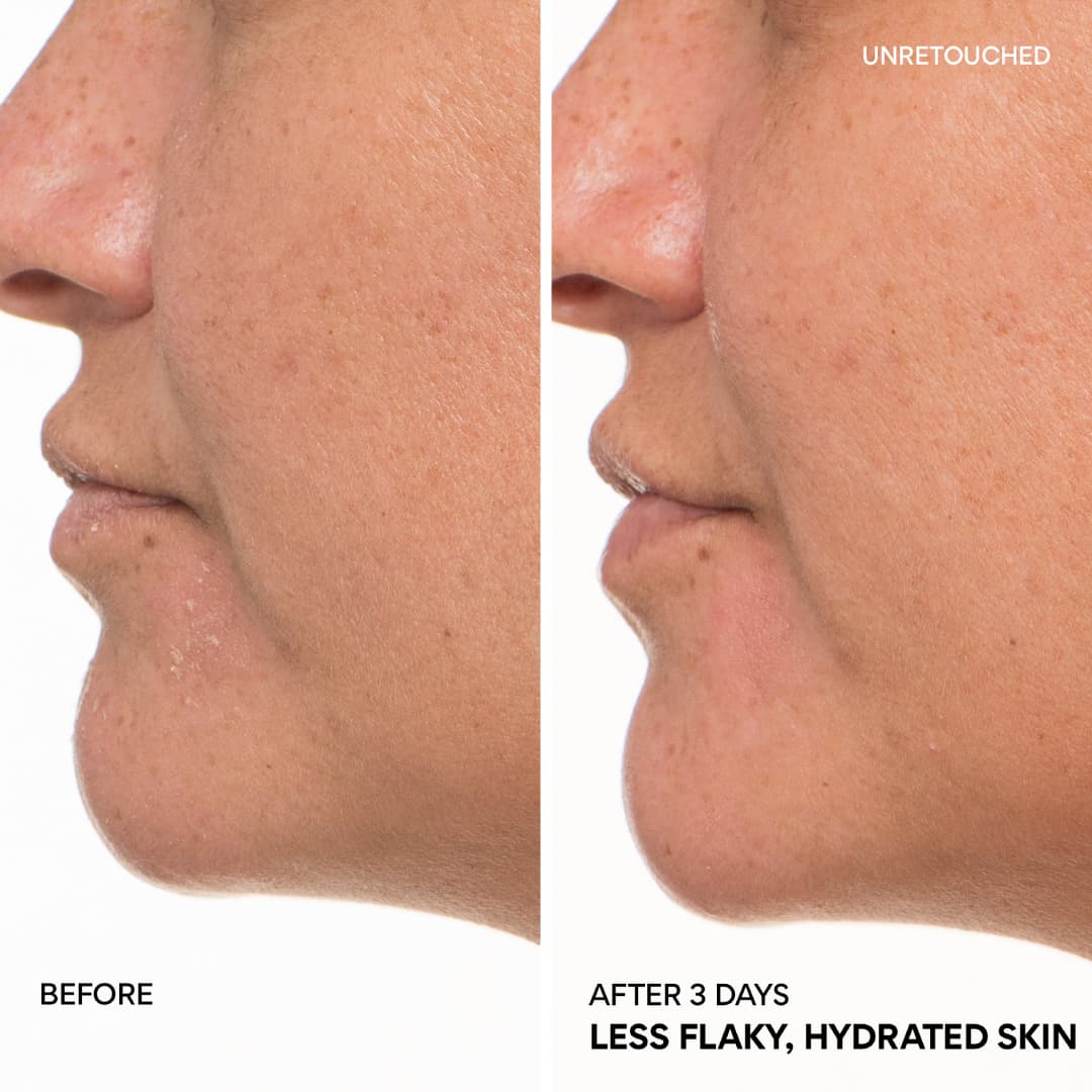 Green Tea Ceramide Milk before and after 3 days, less flaky, hydrated skin