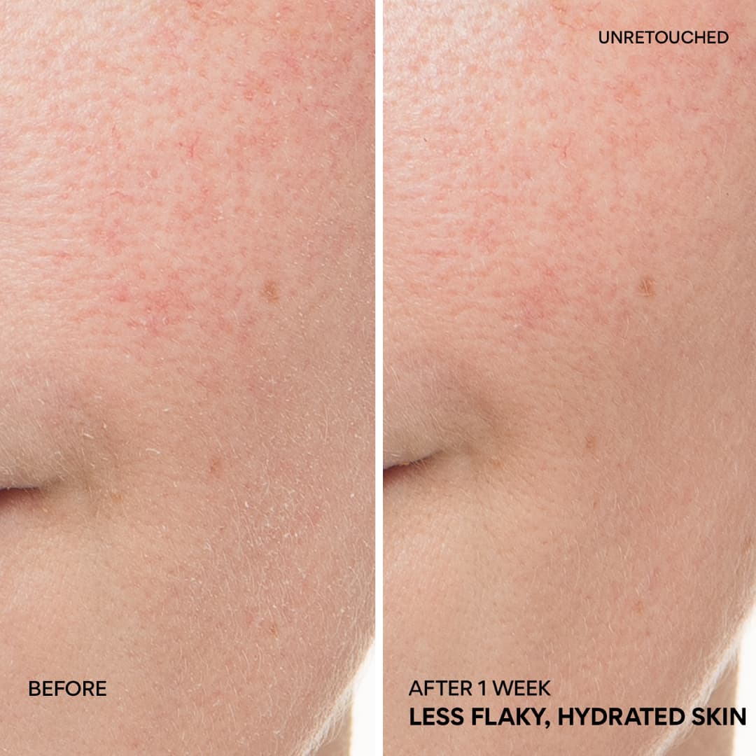 Green Tea Ceramide Cream before and after 1 week, less flaky, calmed skin