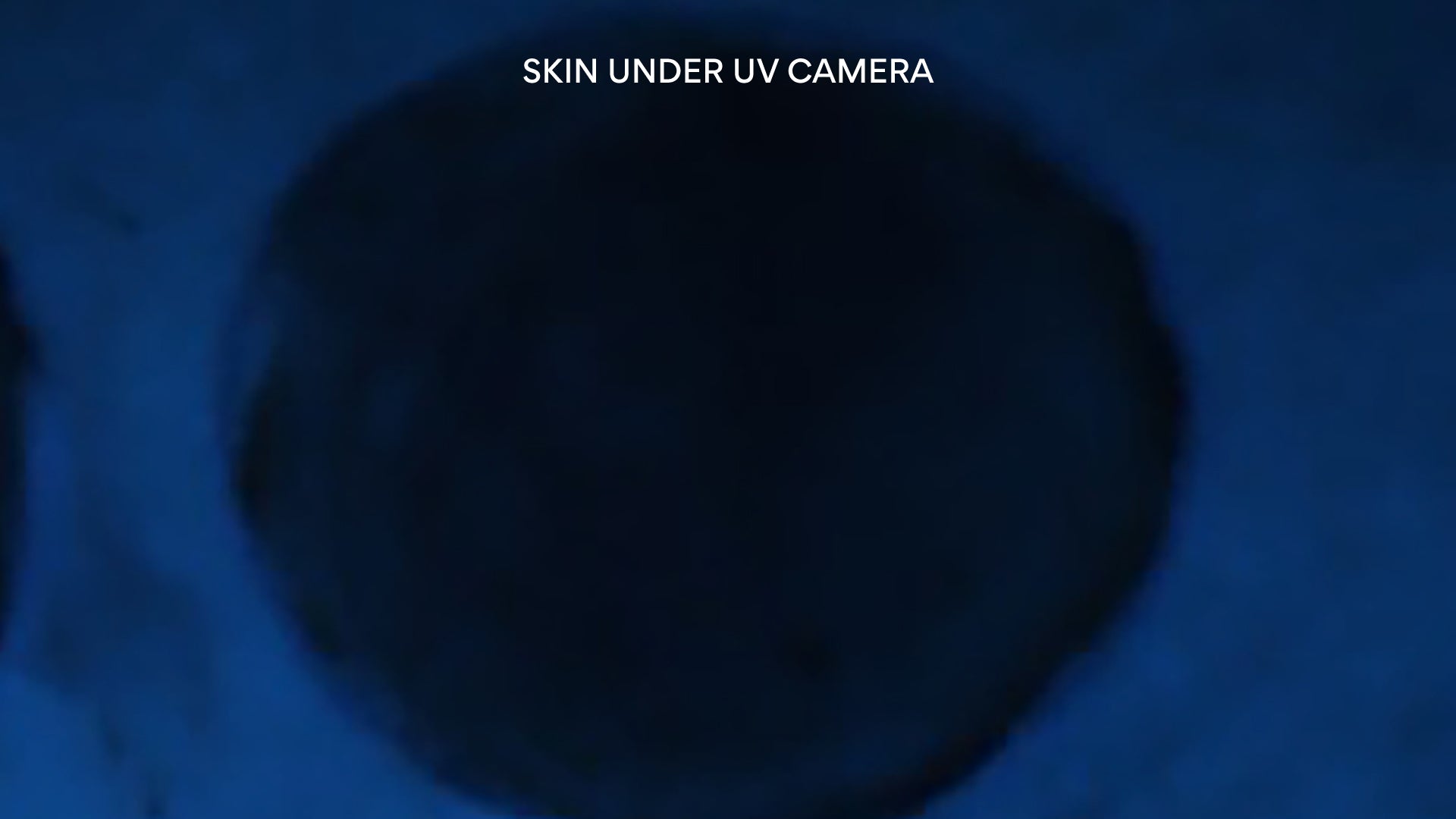 Vitamin C Brightening Mask-to-Foam™ Cleanser skin under UV camera before with sunscreen 