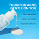 Enlarge image of Gentle Retinol Salicylic Acne Serum