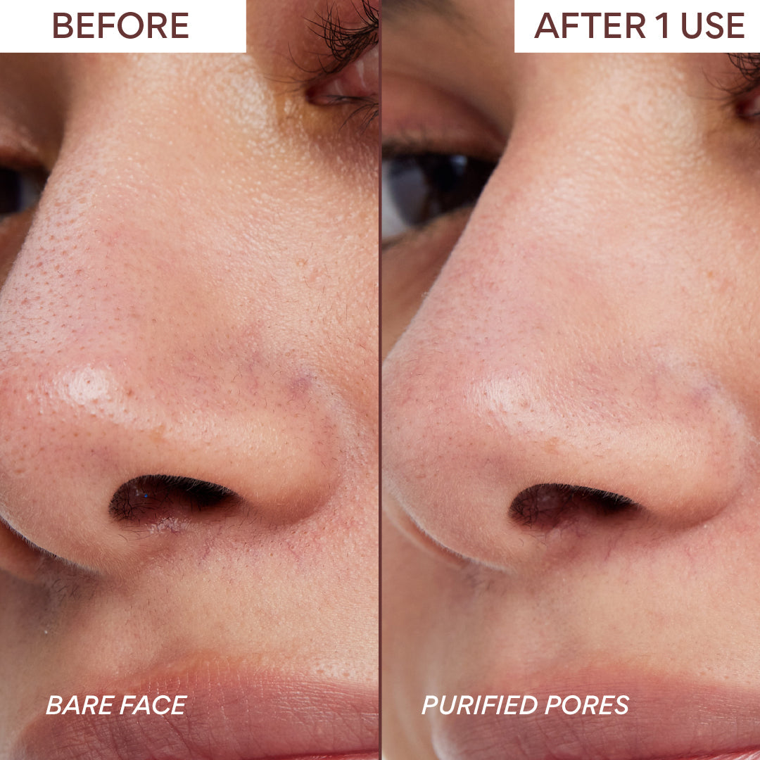 Volcanic clay mask before and after