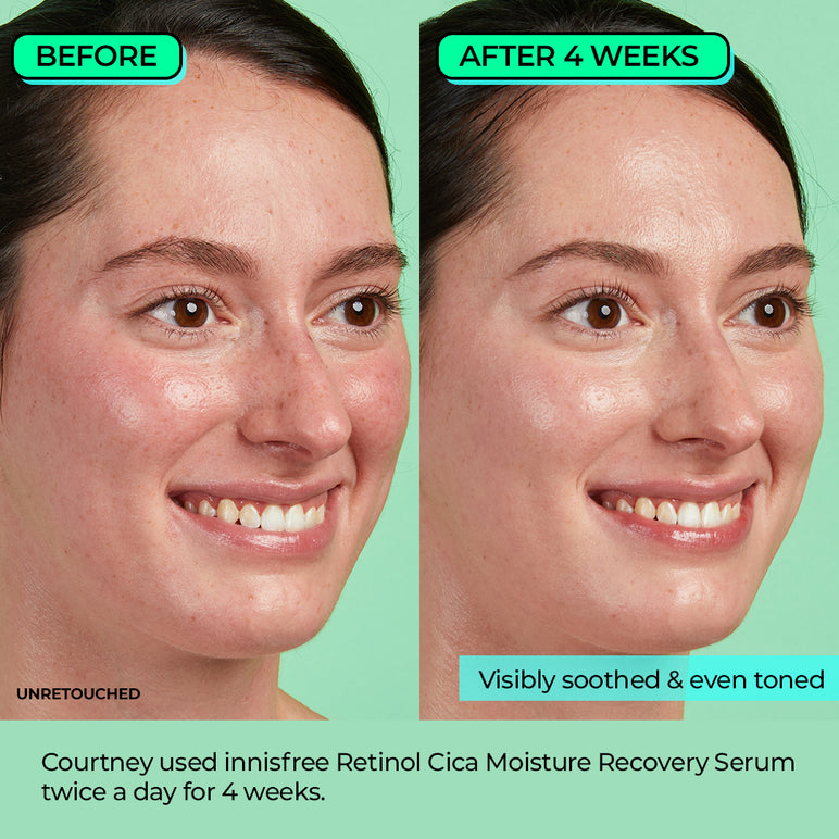 Retinol Cica Moisture Recovery Serum innisfree